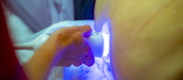 Person having a Fibroscan